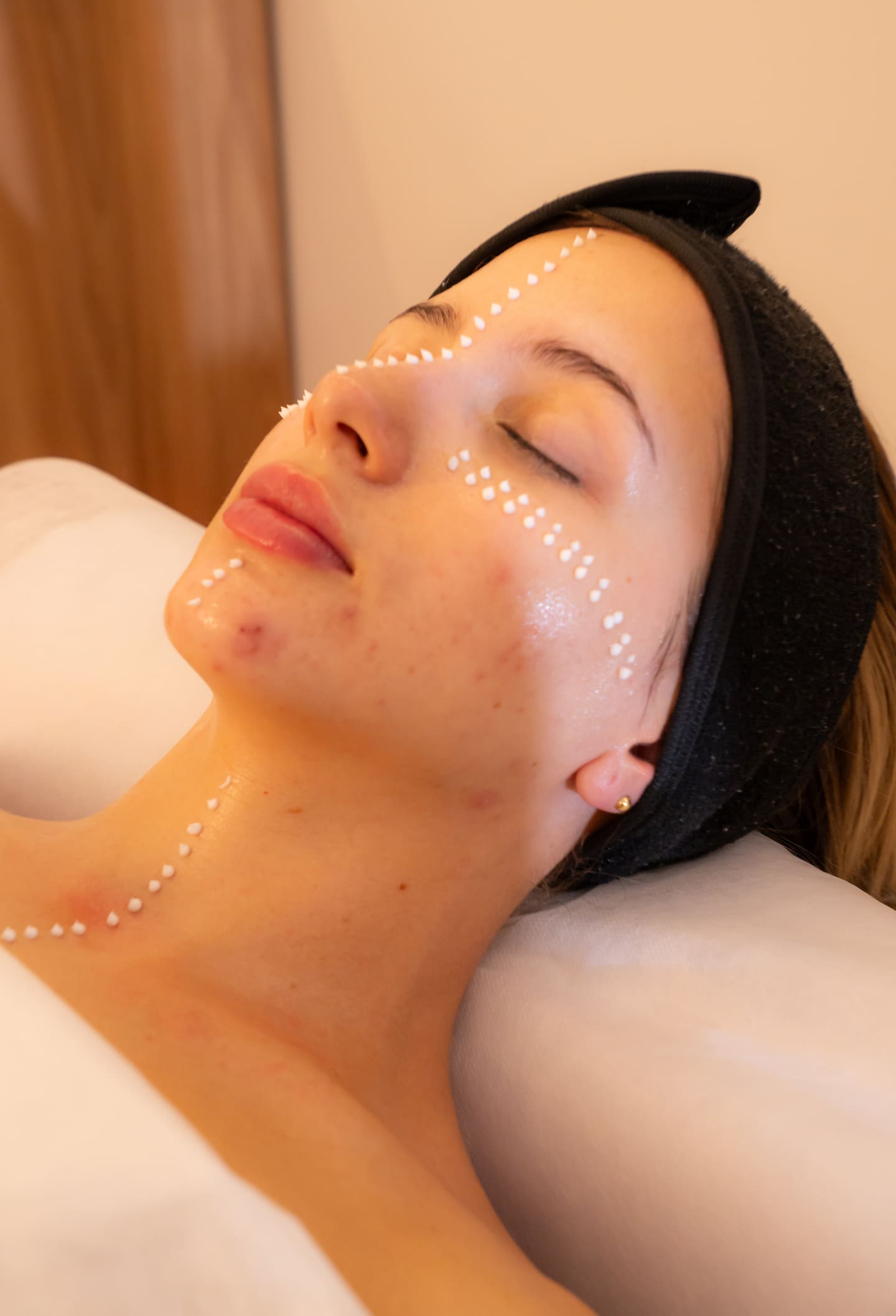 Detalle del mapeo facial con puntos sobre la piel durante la valoración